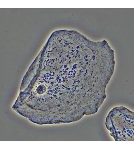 MAGUS PH2 Phase Сontrast Device