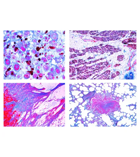 LIEDER Patologinė histologija veterinarinei medicinai, 22 skaidrės
